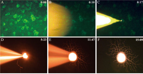 Single cell injection